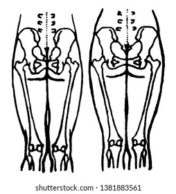 This illustration represents Position of the Pelvic and Thigh Bones in the Male and Female, vintage line drawing or engraving illustration.