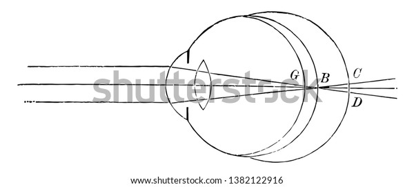 This Illustration Represents Position Retina Near Stock Vector Royalty Free