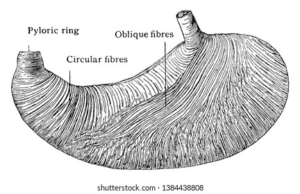 This illustration represents Stomach Turned Inside Out, vintage line drawing or engraving illustration.