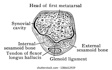 This illustration represents Transverse Section Through Metatarsal, vintage line drawing or engraving illustration.