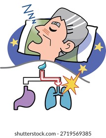 Esta es una ilustración de alguien aspirando mientras duerme.