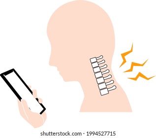 This Is An Illustration Of A Straight Neck (text Neck).