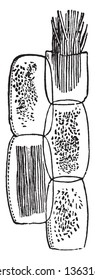 This image of Rhubarb plant cells. Three in this chlorophyll and two Rhaphides are shown, vintage line drawing or engraving illustration.