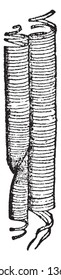Esta es Melon Fibers. Parecen ser vasos primaverales o espirales del Melón, muestran las fibras elásticas desenrolladas, y la fibra venosa se solapa con sus extremidades puntiagudas, vintage