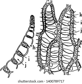 This is Sphagnum Leaf. Sphagnum leaves have unique & unusual arrangement of two different kinds of cells. Most obvious cells are large hyaline cells, which have thickened bands of supporting material