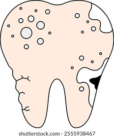 This vector illustration depicts a tooth in poor condition, showing signs of decay, cracks, and infection.