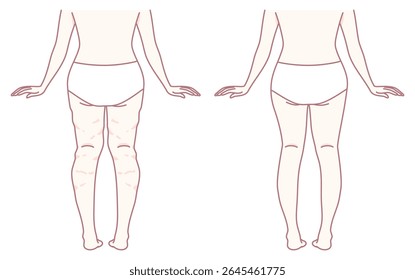 This is a visual representation showcasing different leg shapes that illustrate an impressive transformation process