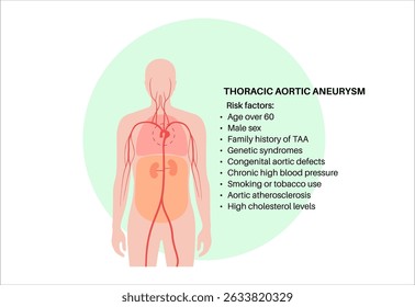 Thoraxaortenaneurysma im menschlichen Körper. Hauptrisikofaktoren. Schmerzen, Bluthochdruck, Entzündungen an der Brust. Vergrößerter Brustkorbabschnitt. Medizinisches Diagramm, Vektor der erweiterten Blutgefäße