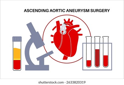 Cirurgia aberta de aneurisma da aorta torácica. O cirurgião repara ou substitui o segmento aórtico aumentado por enxerto sintético. Procedimento cardiovascular, reparo aórtico, operação hospitalar vetor ilustração médica