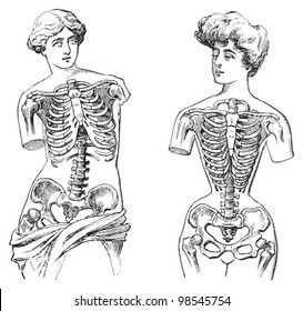 Thorax - Venus de Milo (izquierda) y mannequina (derecha) / ilustraciones antiguas de Die Frau als Hausarztin 1911