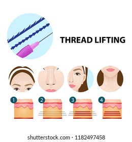 Thread lifting vector illustration