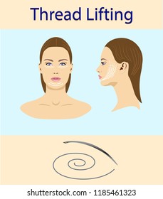 Thread lifting, vector illustration, face of a girl