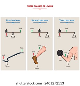 The three classes of levers systems