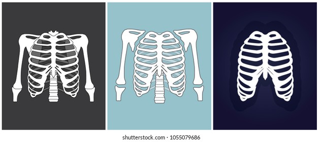 Three different x-rays of chest. Vector illustration.