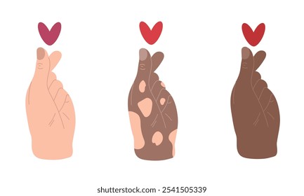 Três mãos com diferentes tipos de pele estão empurrando o gesto de amor com o polegar e o dedo indicador. Ilustração vetorial desenhada à mão em estilo plano. Conceito de amor, gesto de dedo na moda, ícone.