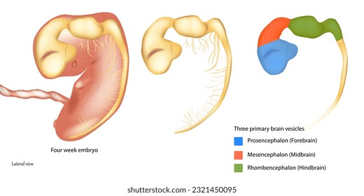 Three primary brain vesicles. Four week embryo. Prosencephalon or Forebrain, Mesencephalon or Midbrain, Rhombencephalon or Hindbrain.