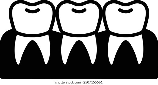 Three teeth are shown in a row, with the top teeth showing more of their surfaces than the bottom teeth