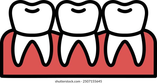 Three teeth are shown in a row, with the top teeth showing more of their surfaces than the bottom teeth