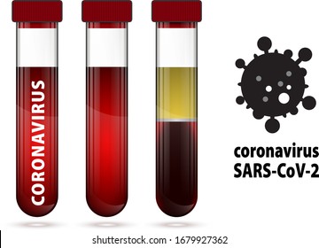 Three Test Tube With Blood And Serum With Label COVID-19