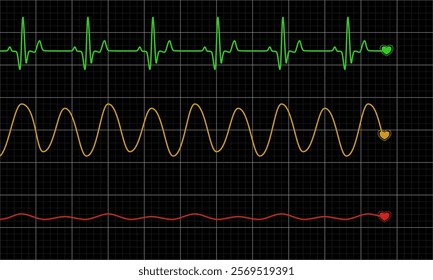 Three types of normal and abnormal heart rhythm. Vector Medical Illustration.