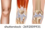 Three Views of Human Knee Joint Anatomy with Muscles and Ligaments. Medical Diagram of Human Knee Bones, Tendons, and Ligaments