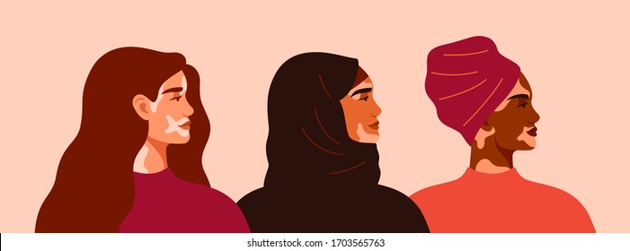 Tres mujeres con vitiligo de diferentes nacionalidades paradas juntas. Concepto de apoyo a las personas que viven con vitiligo y de sensibilización sobre el trastorno crónico de la piel.Ilustración vectorial