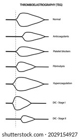 Thromboelastography (TEG). Blood coagulation analysis types. Different types of results 