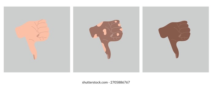 Geste mit dem Daumen nach unten. Weiße, dunkle und vitiligo Haut Hand. Konzept der Vielfalt, Inklusivität. Handgezeichnete Vektorgrafik im flachen Stil. Symbol ablehnen, menschlicher Arm, Webbanner