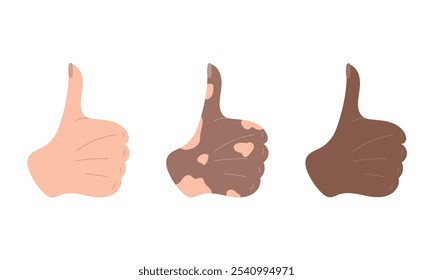 Thumb up gesture. Hand drawn vector illustration in flat style. Symbol of ok, approve, like. Web icon design. White, dark and vitiligo skin. Concept of diversity, communication