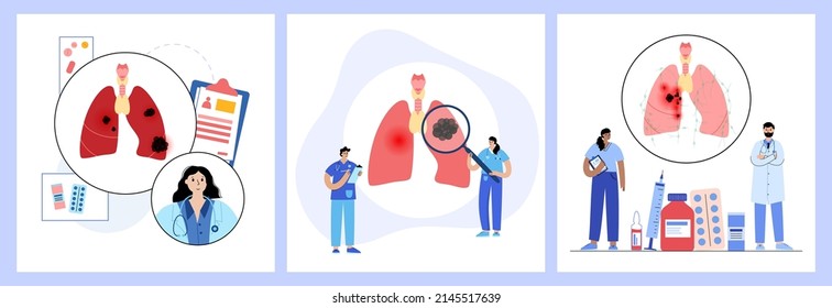 Thyroid cancer stages. Doctors consultation and treatment in clinic. Thyroid gland, trachea and lymph nodes. Pain and tumor in human endocrine system. Internal organs exam flat vector illustration.
