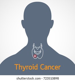 Thyroid Cancer vector icon illustration