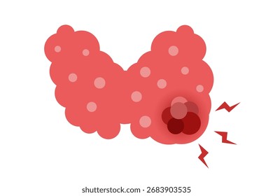 thyroid disease concept. vector illustration