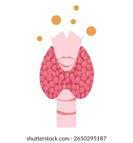 Thyroid disease illustration. Graves’ disease 