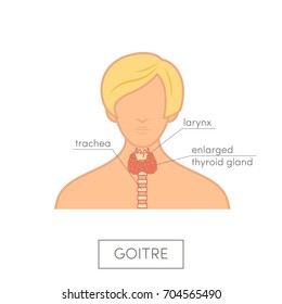 Thyroid gland anatomy of female. Cartoon vector diagram for medical atlas or educational textbook