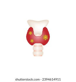 Thyroid gland cancer, unhealthy thyroid with Inflammation and lump. Vector illustration isolated on white background.