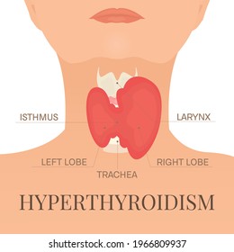 Thyroid Gland Trachea Front View On Stock Vector (Royalty Free ...