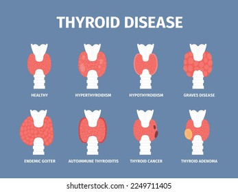 Thyroid gland various diseases. Goiter and hyperthyroid, inflammation trachea icons. Endocrinology disease, cancer and thyroiditis, recent vector set