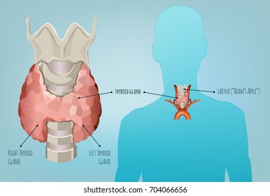 Thyroid gland vector illustration. Medical anatomy with throat, bone and trachea with useful information shown on a human body silhouette isolated on a light blue background.