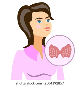 thyroid gland, woman with thyroid gland