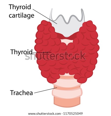 Thyroid healthy and enlarged thyroid. hypothyroid vector illustration on a white background