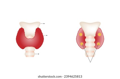 Thyroid and parathyroid gland. Anatomy front and back view of thyroid gland. hypothyroidism vs hyperthyroidism. Vector illustration isolated on white background.