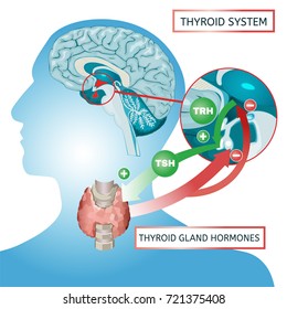 1,027 Thyroid infographics Stock Illustrations, Images & Vectors ...