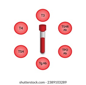 Thyroid test, Thyroid gland. TSH, T3, T4 hormones. Thyroglobulin, Thyroid peroxidase and Thyroid stimulating hormone receptor antibodies. Hypothyroidism and hyperthyroidism. Vector illustration.