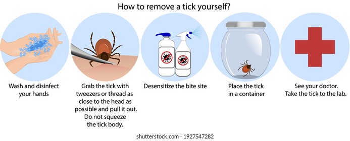 Tick Bite Activities. Vector Illustration