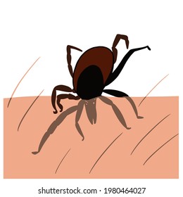 Tick bite, dug into the skin.  Ixodes ricinus. Bloated parasite bitten into pink irritated epidermis. Small red drops. Dangerous insect mite. Encephalitis, Lyme disease infection. 