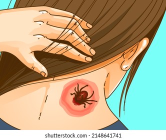 Tick bite. A young girl with a tick on her neck. Discover a tick on the neck under the hairs.  Healthcare illustration. Vector illustration.