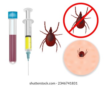 Tick-borne encephalitis vaccination.Tick bite protection Vaccination against ticks. Prevention of infections transmitted by parasites. Vector