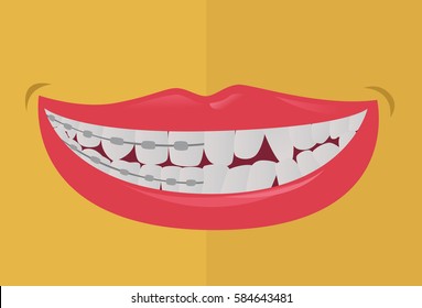 tidied with braces before after used teeth untidy