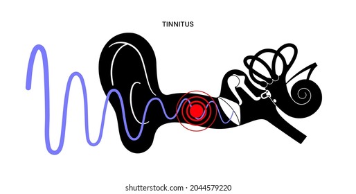 Tinnitus disease concept. Pain, inflammation in human ear. Symbol of earache, ringing and loud sounds in ears. Medical checkup of hearing organs, neurology problems treatment flat vector illustration.