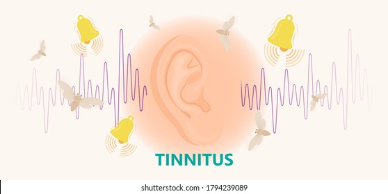 Tinnitus disorder a ringing sound in the ear hearing loss wave level anxiety test assist exam inner exposure problem circulatory nerves hair cell canal Earwax